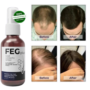 FEG Plus Hair Growth Spray – Nourishing Hair Regrowth & Hair Strengthening Spray for Men & Women